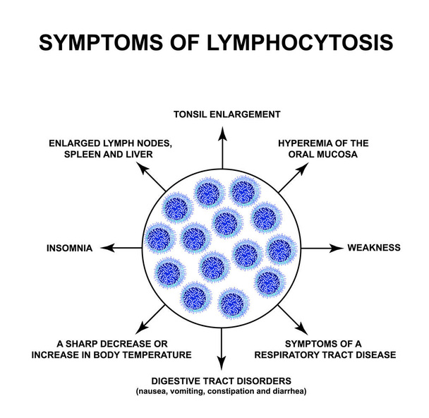 Symptoms of Lymphocytosis. The increase in lymphocytes in the blood. Cell killers. Immunity Helper Cells. Infographics. Vector illustration on isolated background. - Vector, Image