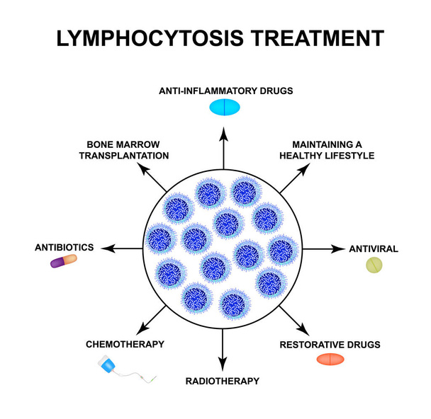 Léčba lymfocytózy. Zvýšení počtu lymfocytů v krvi. Buněční vrazi. Imunitní pomocné buňky. Infographics. Vektorová ilustrace na izolovaném pozadí. - Vektor, obrázek
