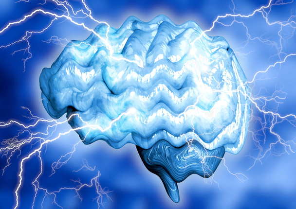 La epilepsia es una enfermedad cerebral crónica causada por el aumento de la actividad eléctrica de las neuronas. Se manifiesta a través de convulsiones involuntarias y pérdida momentánea de la conciencia
. - Foto, imagen