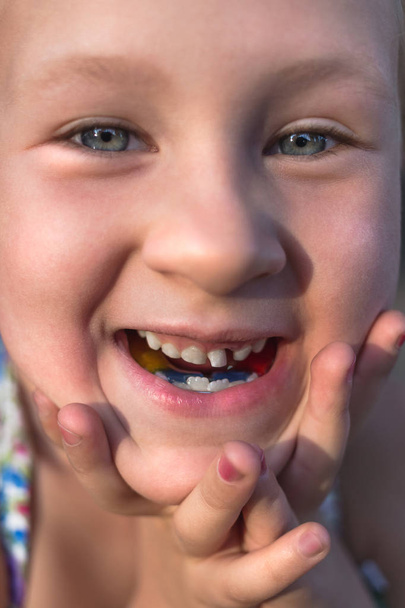 Little girl with orthodontics appliance and crooked teeth. Wobbl - Photo, Image