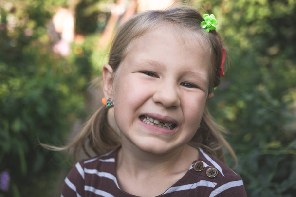 Enfant avec un dispositif orthodontique dentaire et sans une dent - Photo, image