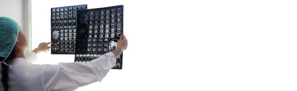 Az orvos egy képet tart az agyáról MRI  - Fotó, kép