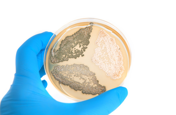 генетически модифицированные грибы на агарной пластине
 - Фото, изображение