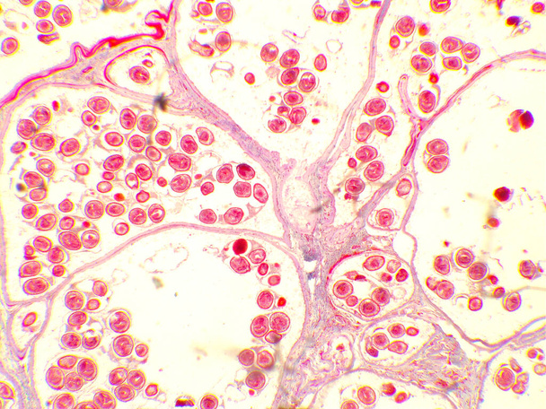 顕微鏡下でのハイブリッド嚢胞(100倍).エキノコッカスグラニューロース.犬のタペワーム寄生虫. - 写真・画像