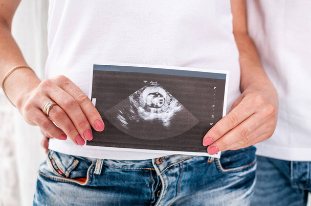 Manželka a manžel drží ultrazvuk obrázek dítěte v děloze - Fotografie, Obrázek