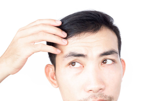 Fiatal férfi komoly hajhullás probléma az egészségügyi ellátás orvosi és sampon termék koncepció, szelektív fókusz - Fotó, kép