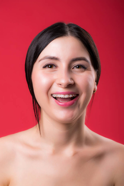 Portrait of a beautiful woman with braces on teeth. Orthodontic Treatment. Dental care Concept - Photo, Image