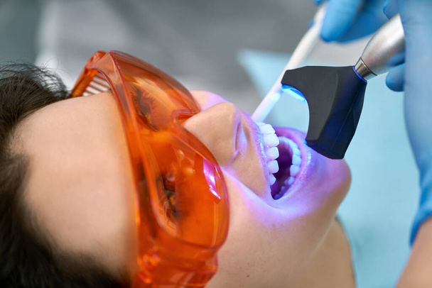 Pretty womans teeth treatment in dental clinic - Photo, image