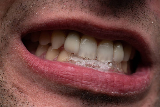 Obrázek muže s otevřenými ústy, ukazující zuby - Fotografie, Obrázek