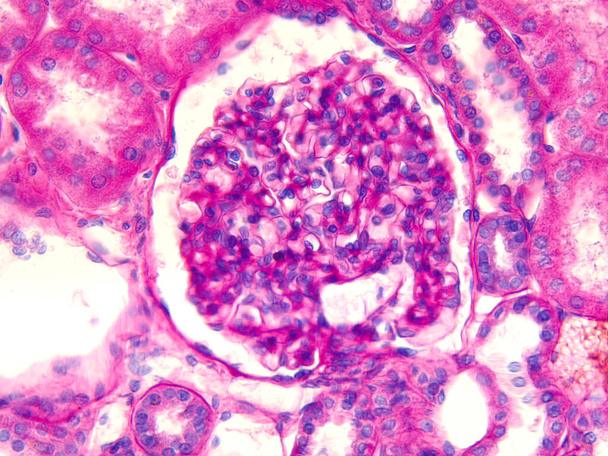 Mikroszkopikus fénykép egy glomerulusról az emberi vesében. - Fotó, kép