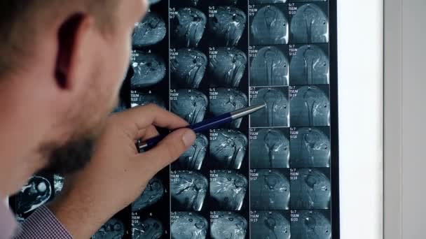 Dokter in het ziekenhuis kijkt naar röntgenfoto MRI scan. - Video