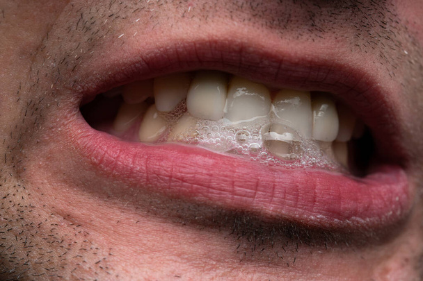 Dişlerini gösteren genç bir adam resmi, yakın çekim. - Fotoğraf, Görsel