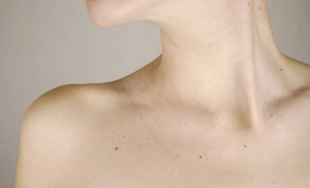 kin hals en sleutelbeen van een meisje met veel moedervlekken op de huid close-up - Foto, afbeelding