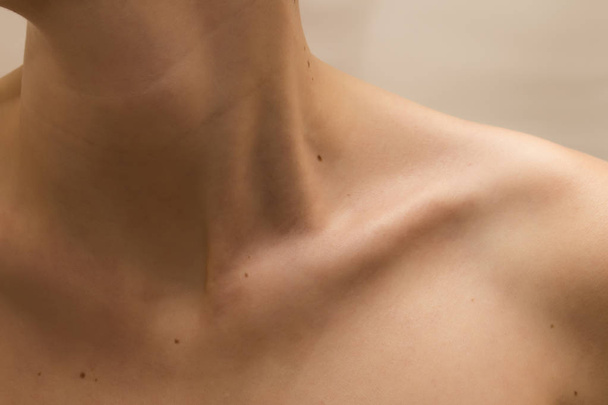 Clavículas femeninas y cuello con lunares en la piel - Foto, imagen