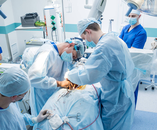 Chirurgii kręgosłupa. Grupa chirurgów w sali operacyjnej z wyposażeniem chirurgicznym. Laminektomii. Nowoczesne tło medyczne - Zdjęcie, obraz