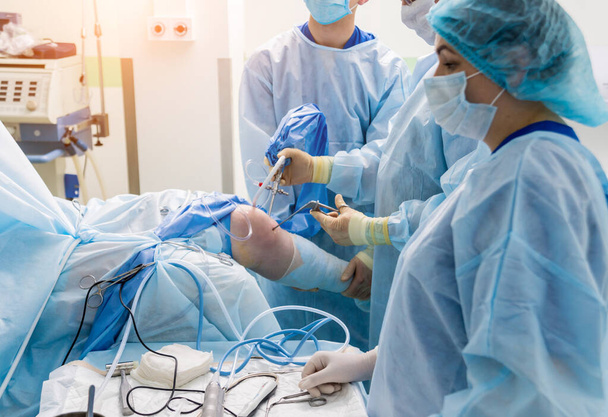 Arthroscope surgery. Orthopedic surgeons in teamwork in the operating room with modern arthroscopic tools. Knee surgery. Hospital background - Zdjęcie, obraz