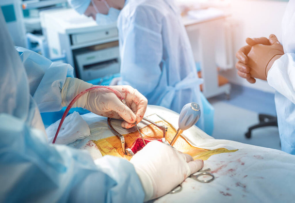 脊髄手術手術装置が付いている手術室の外科医のグループ。ラミネクトミー現代の医学的背景 - 写真・画像