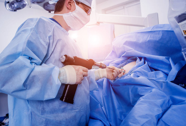 Arthroscope surgery. Orthopedic surgeons in teamwork in the operating room with modern arthroscopic tools. Hospital background - Fotó, kép