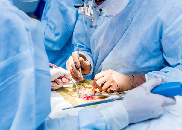 Spinal surgery. Group of surgeons in operating room with surgery equipment. Laminectomy. Modern medical background - 写真・画像