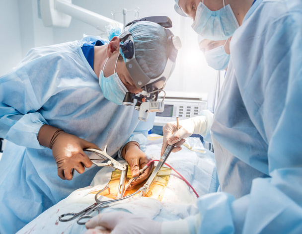 Spinal surgery. Group of surgeons in operating room with surgery equipment. Laminectomy. Modern medical background - Foto, Imagem