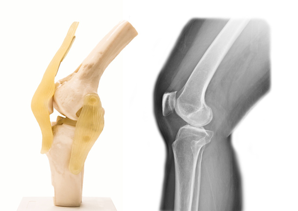 Kunstmatig humaan kniegewricht model in de medische - Foto, afbeelding