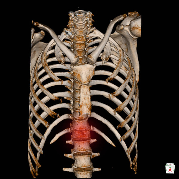 CT Scan 3D rende il sistema scheletrico umano (scheletro toracico
) - Foto, immagini