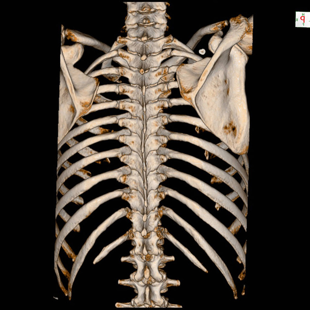 Ct Scan 3d render Emberi csontváz rendszer (Mellkasi csontváz) . - Fotó, kép