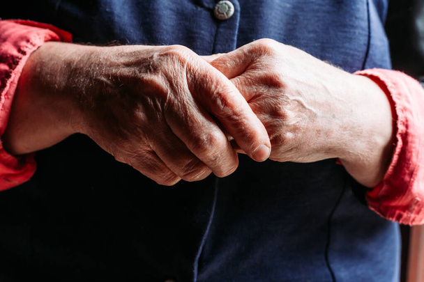 Older woman hands. Rheumatism, arthritis, joint pain - Fotoğraf, Görsel