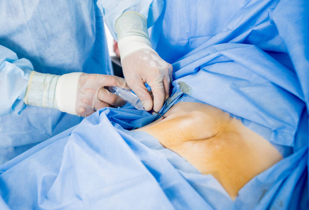 Artroskooppi leikkaus. Ortopediset kirurgit ryhmätyössä leikkaussalissa nykyaikaisilla artroskooppisilla työkaluilla. Sairaalan tausta
 - Valokuva, kuva