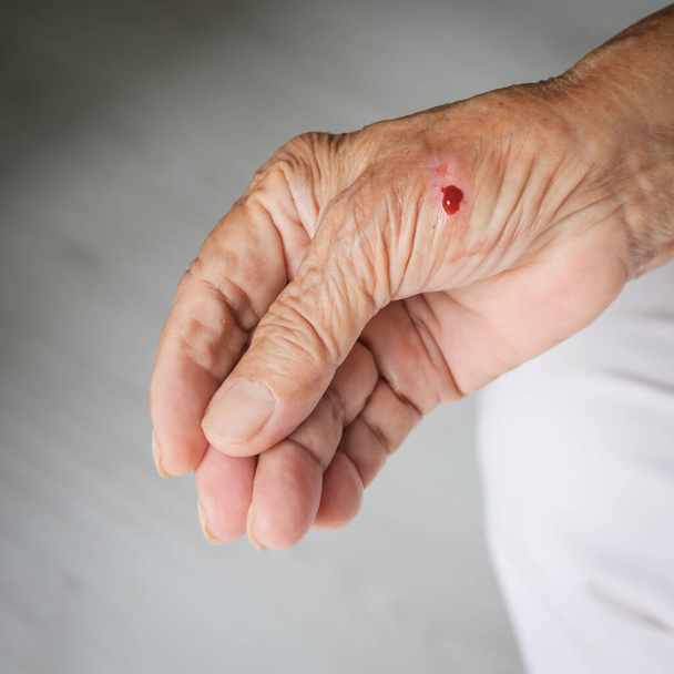 Senior hand with blood, accident at home. - Photo, Image