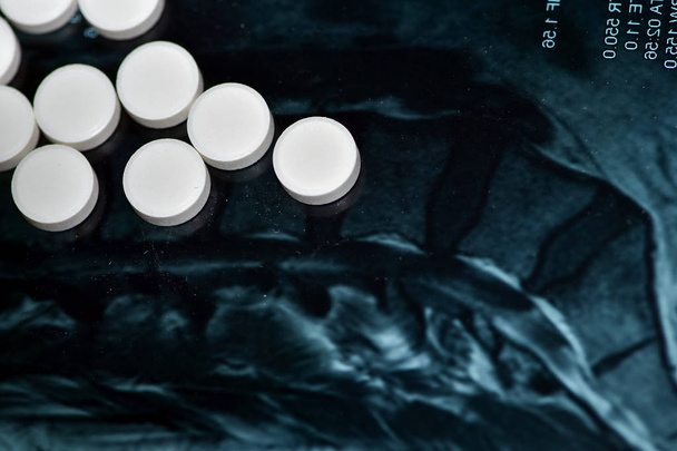 Medicinale pillen op een stoffige Mri afbeelding van de cervicale wervelkolom achtergrond - Foto, afbeelding