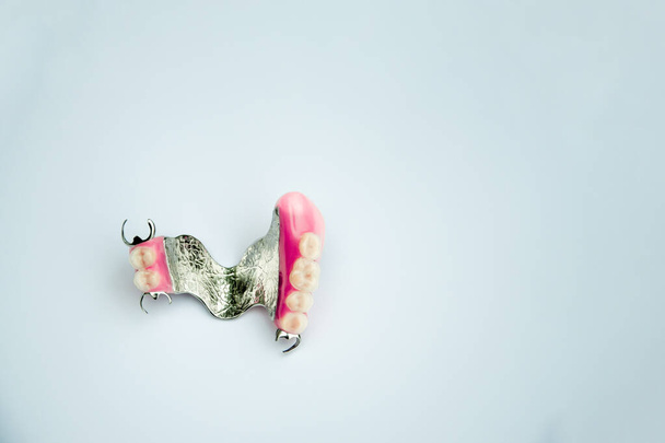 prótesis dentales de metal. prótesis de arco. dientes postizos. Clammer superior dentadura extraíble
 - Foto, Imagen