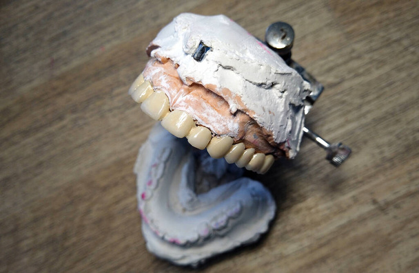 dentista ortodoncista, proceso de fabricación de prótesis dental
 - Foto, Imagen