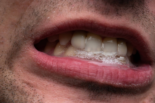 Image d'un jeune homme avec de la salive, montrant des dents
 - Photo, image