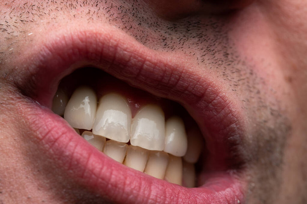 Imagen de un joven con la boca abierta, foto de cerca
 - Foto, Imagen