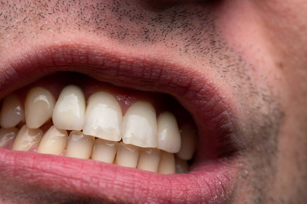 Imagen del hombre con la boca abierta, foto de cerca
 - Foto, imagen