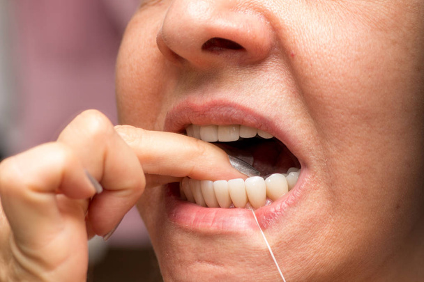Женщина ломает зубы за хорошую гигиену зубов
 - Фото, изображение