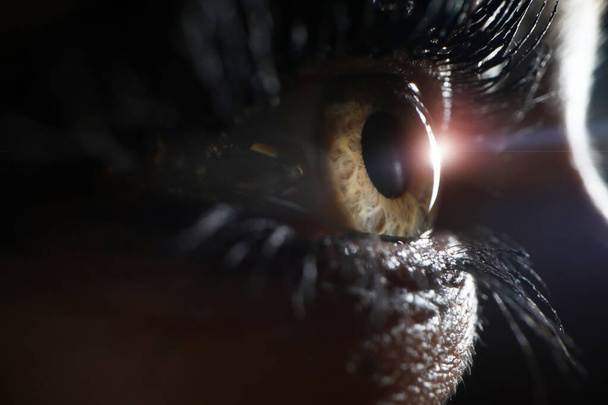 Женский глаз при осмотре хирургической клиники крупным планом
 - Фото, изображение
