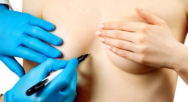 Médico mão pintura linha pontilhada no peito feminino antes da cirurgia plástica
. - Foto, Imagem