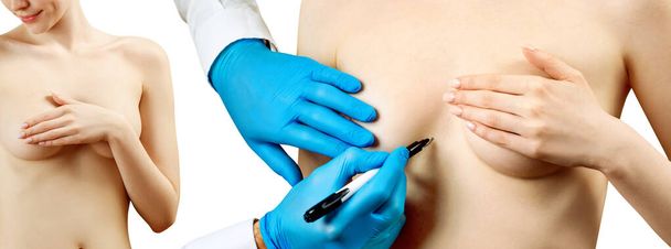 Doktor ručně malovat tečkované čáry na ženské prsa. - Fotografie, Obrázek