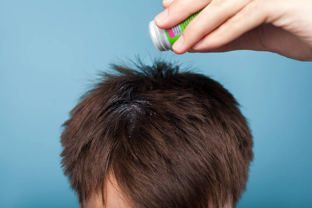 Closeup of male hand applying medications on brunette male hair. - Photo, image