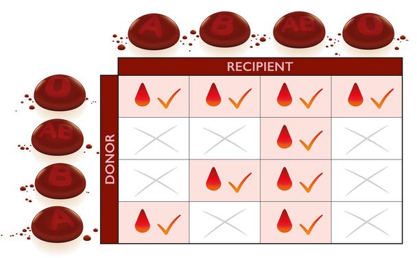 Wykres zgodności transfuzji grup krwi z kolumną i wierszem dla dawcy i biorcy. Pola kompatybilne ze znakami kontrolnymi, skrzyżowane pola niekompatybilne ze względu na niekompatybilność. - Wektor, obraz