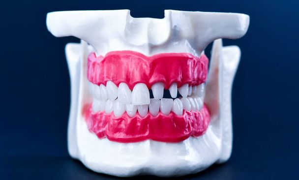Human jaw with teeth and gums anatomy model - Фото, изображение