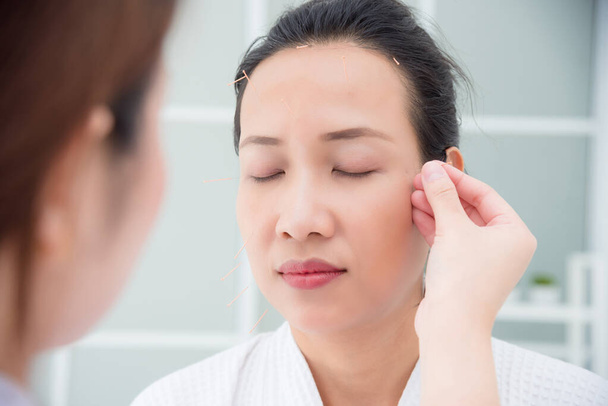 Gyönyörű ázsiai nő kap arc akupunktúra kezelés a klinikán - Fotó, kép