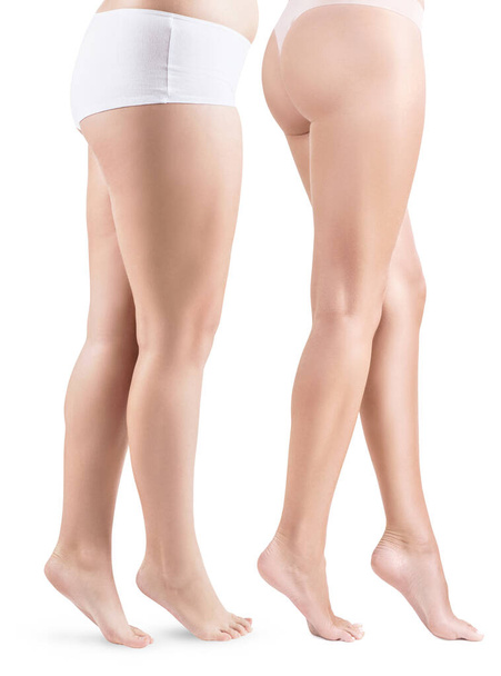 Side view on womans legs before and after slimming. - Fotó, kép