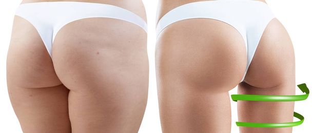 Big spiral arrows shows result of slimming on buttocks. - Photo, Image