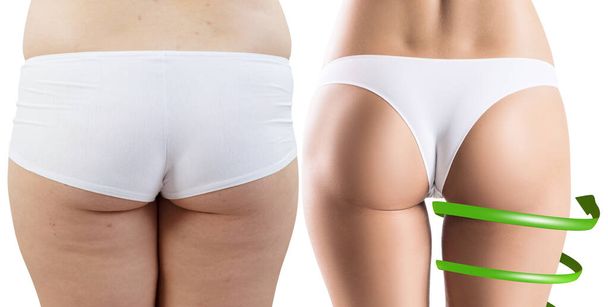Big spiral arrows shows result of slimming on buttocks. - Photo, Image