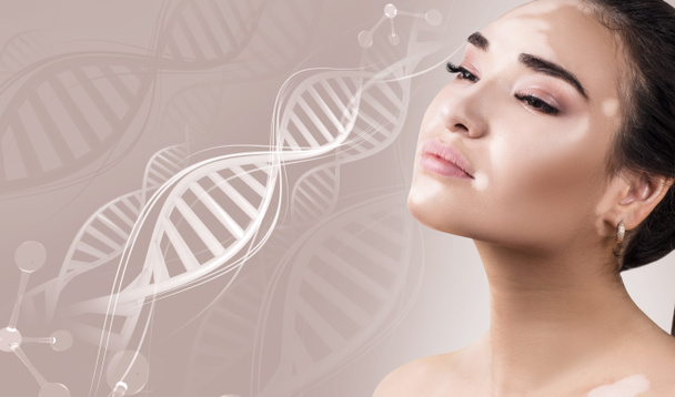 Jeune femme sensuelle avec la maladie du vitiligo dans les chaînes d'ADN
. - Photo, image