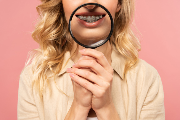 Περικοπή άποψη της γυναίκας με οδοντικά στηρίγματα κρατώντας μεγεθυντικό φακό απομονώνονται σε ροζ - Φωτογραφία, εικόνα