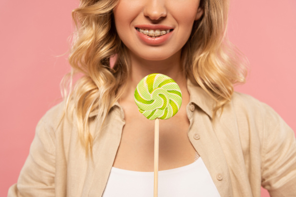 Cropped view of woman with dental braces holding lollipop isolated on pink - 写真・画像